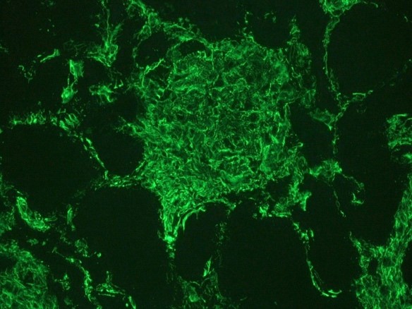 Figure 2. Indirect immunofluorescence staining of human kidney tissue section with MUB1904P (diluted 1:1000), showing the specific pattern of vimentin in the mesenchymal cell types, such as fibroblasts in the connective tissue, podocytes, and endothelial cells in blood vessels. As expected, no reactivity is seen in the epithelial cell compartment.